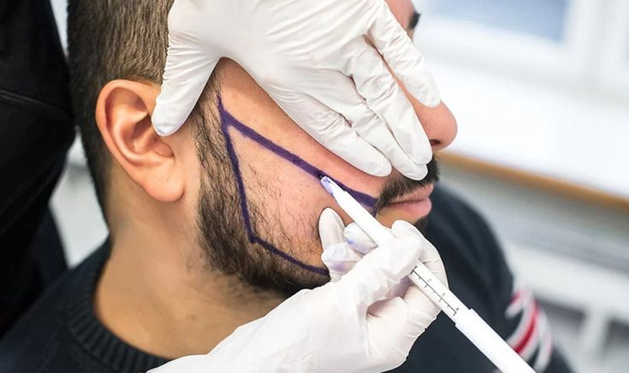 Evaluación para injerto de barba
